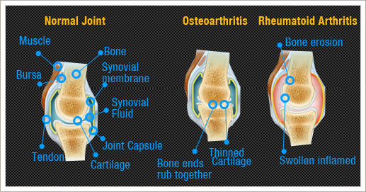 Hip Condition