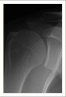 Normal shoulder