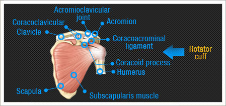 Hip Condition